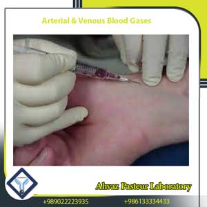 Arterial and Venous Blood Gases